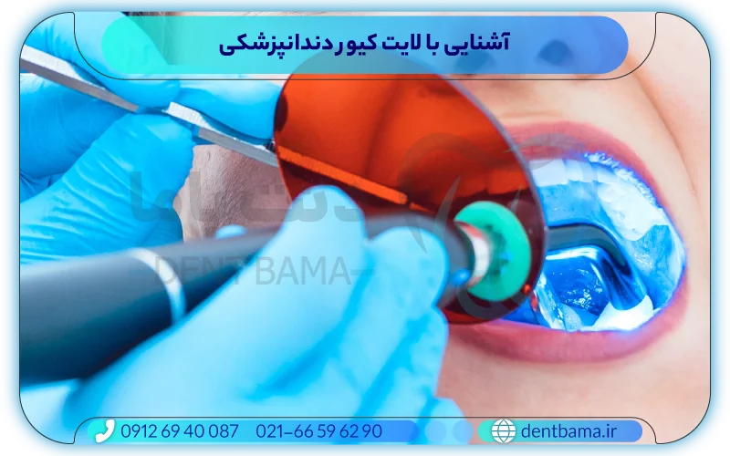 آشنایی با لایت کیور دندانپزشکی