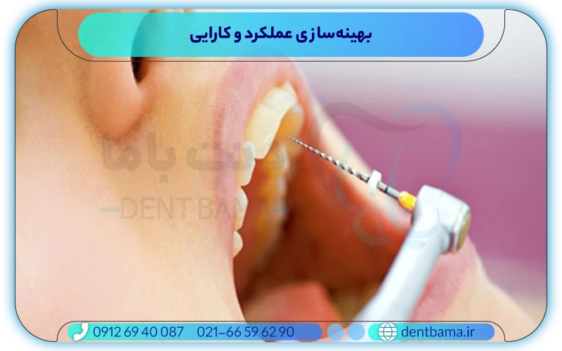 بهینه‌سازی عملکرد و کارایی روتاری دندانپزشکی