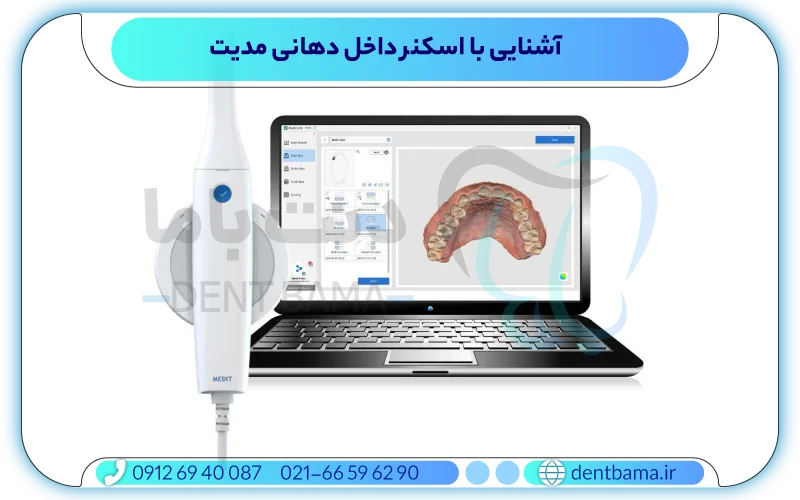 آشنایی با اسکنر داخل دهانی مدیت