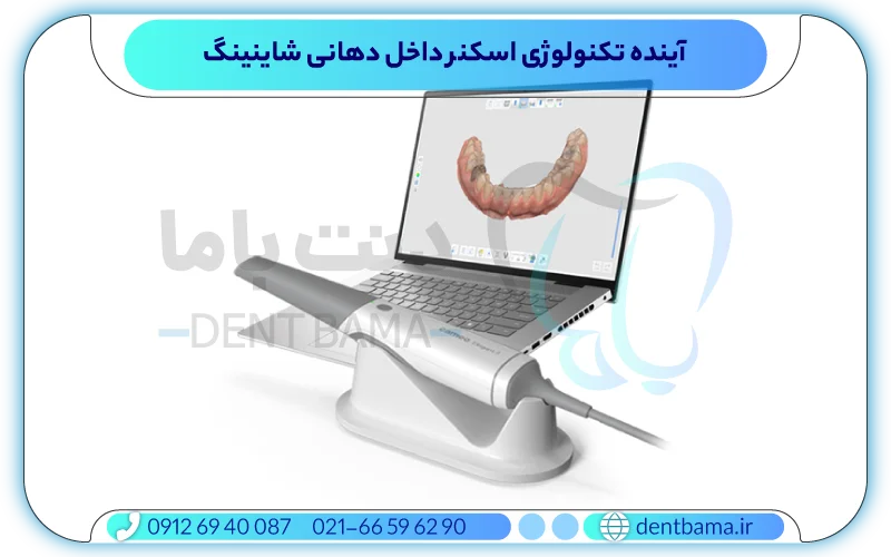 آینده تکنولوژی اسکنر داخل دهانی شاینینگ