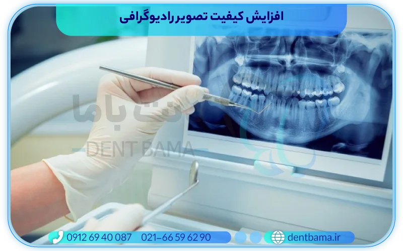 چگونگی افزایش کیفیت تصویر رادیوگرافی دندانپزشکی