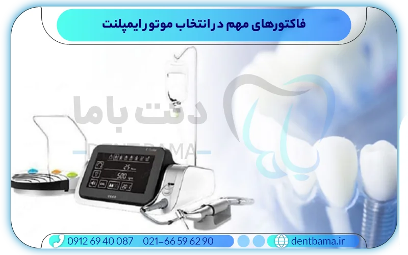 فاکتورهای مهم در انتخاب موتور ایمپلنت