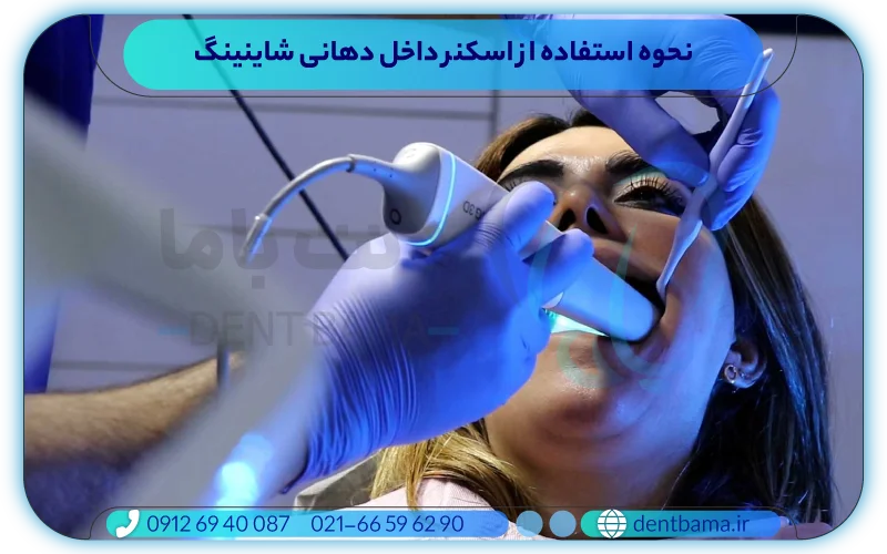 نحوه استفاده از اسکنر داخل دهانی شاینینگ