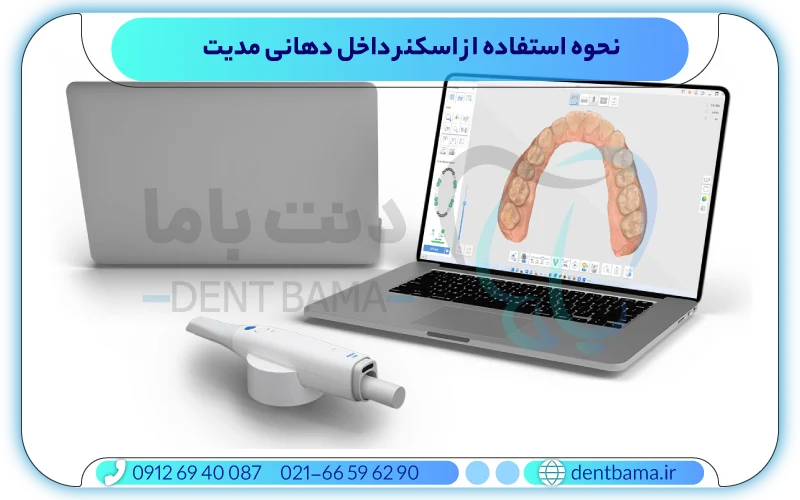 نگهداری درست از اسکنر داخل دهانی مدیت