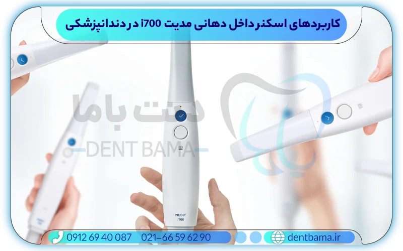 کاربردهای اسکنر داخل دهانی مدیت i700 در دندانپزشکی